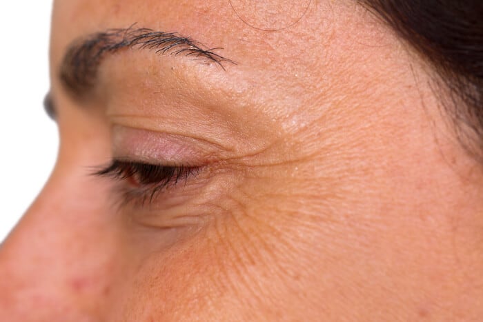 What You Need To Know About Facials For Crow’s Feet